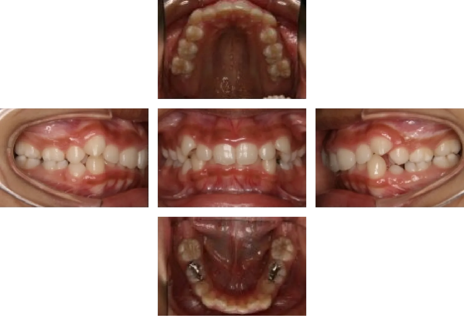 矯正治療の長期経過と保定管理 矯正治療の長期経過と保定管理 - クインテッセンス出版